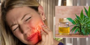 CBD for tooth pain